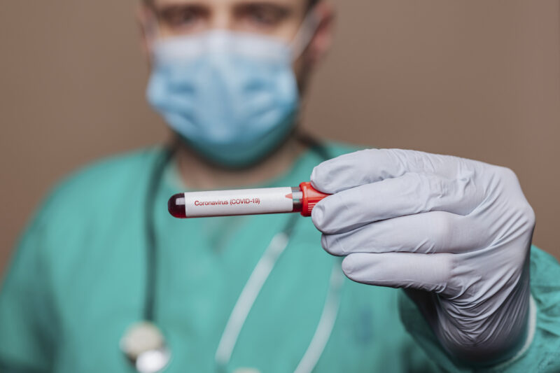 Surgeon holding a covid-19 test tube